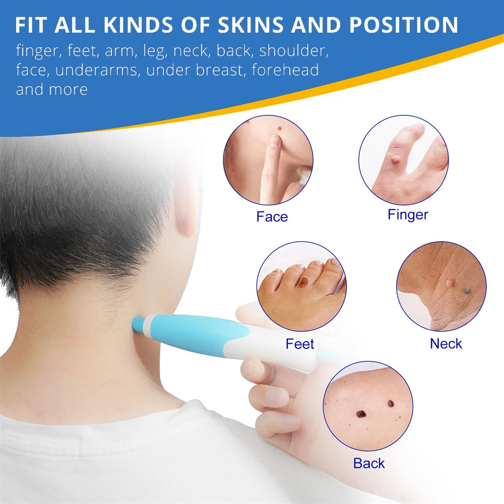 2 IN 1 Auto Micro Skin Tag Remover Kit for Home Use - Hart4Savings Hart4Savings Orange / CHINA Hart 4 Savings Self Care