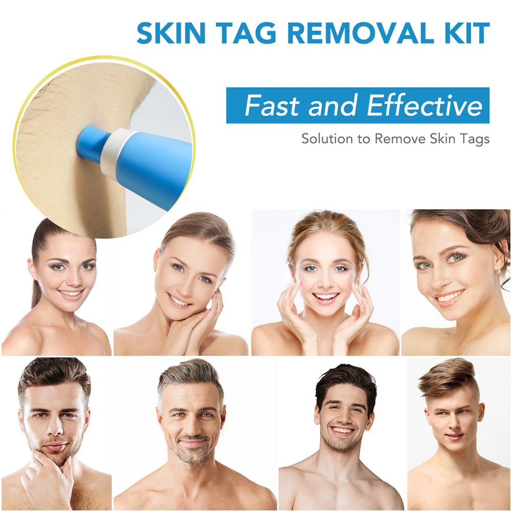 2 IN 1 Auto Micro Skin Tag Remover Kit for Home Use - Hart4Savings Hart4Savings Orange / CHINA Hart 4 Savings Self Care