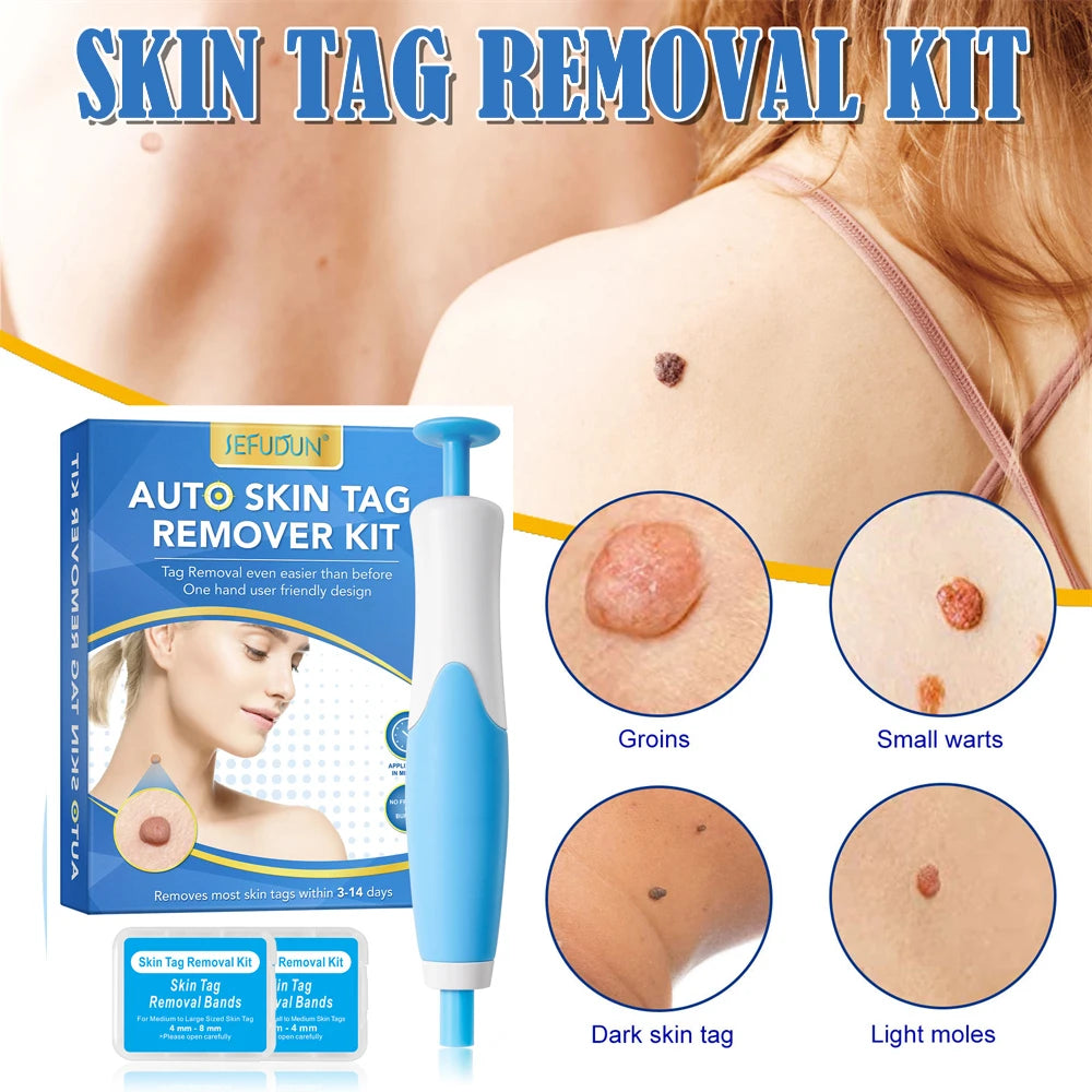 2 IN 1 Auto Micro Skin Tag Remover Kit for Home Use - Hart4Savings Hart4Savings Orange / CHINA Hart 4 Savings Self Care