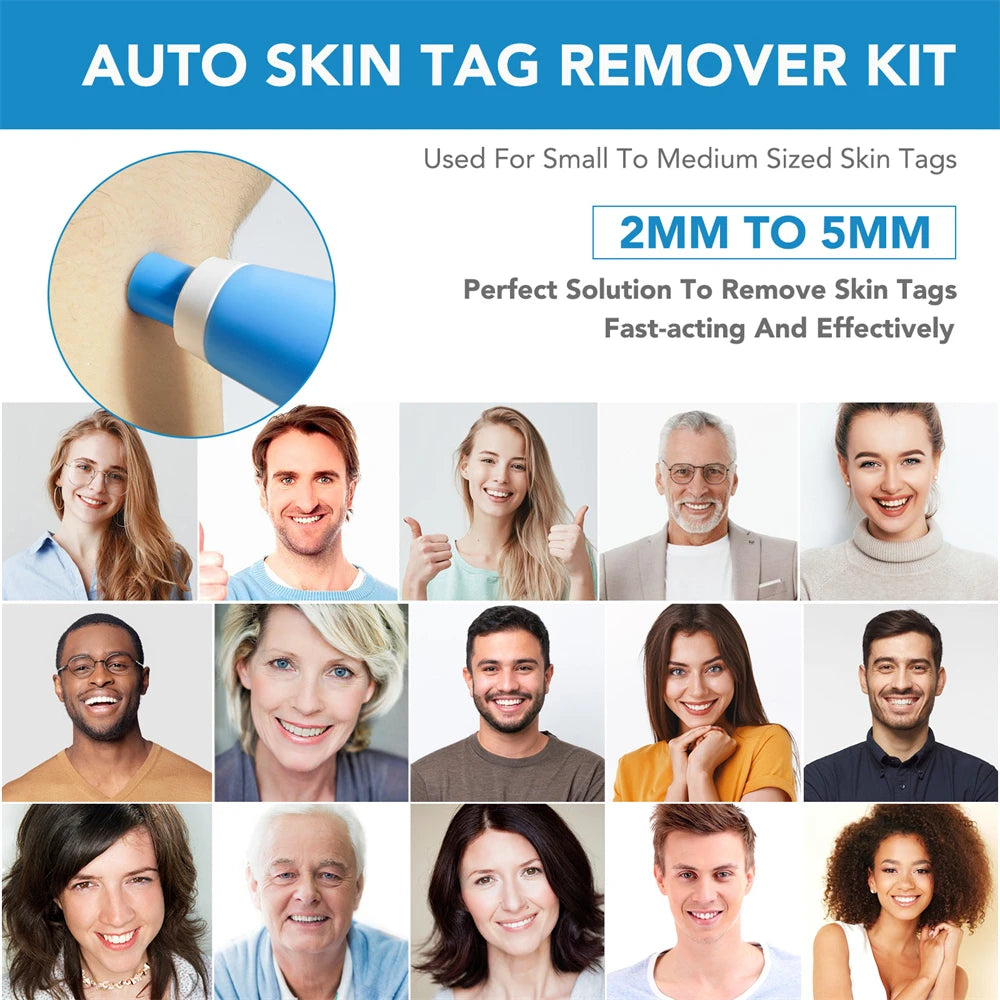 2 IN 1 Auto Micro Skin Tag Remover Kit for Home Use - Hart4Savings Hart4Savings Orange / CHINA Hart 4 Savings Self Care