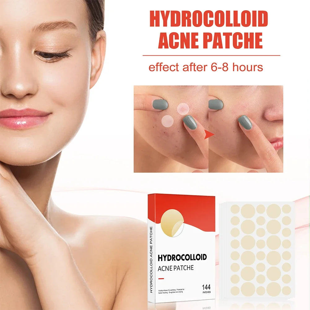 144pcs Invisible Professional Healing Pimple Patches 2 Sizes - Hart4Savings Hart4Savings 144pcs Hart 4 Savings