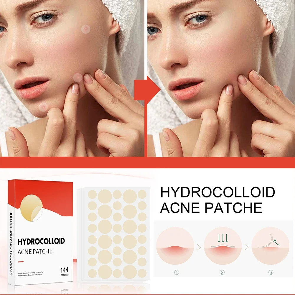 144pcs Invisible Professional Healing Pimple Patches 2 Sizes - Hart4Savings Hart4Savings 144pcs Hart 4 Savings