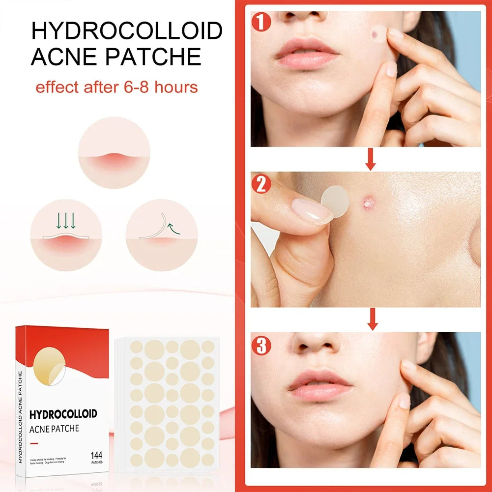 144pcs Invisible Professional Healing Pimple Patches 2 Sizes - Hart4Savings Hart4Savings 144pcs Hart 4 Savings