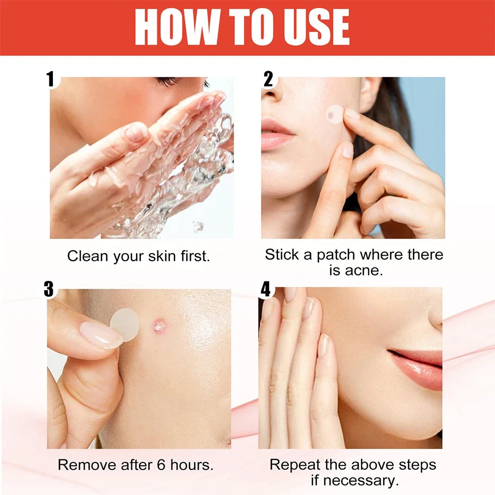 144pcs Invisible Professional Healing Pimple Patches 2 Sizes - Hart4Savings Hart4Savings 144pcs Hart 4 Savings