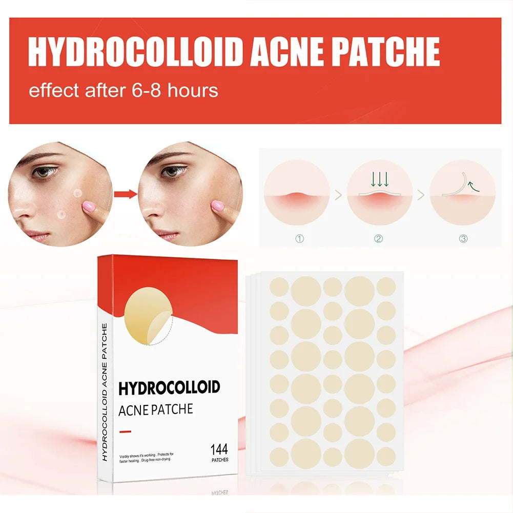 144pcs Invisible Professional Healing Pimple Patches 2 Sizes - Hart4Savings Hart4Savings 144pcs Hart 4 Savings