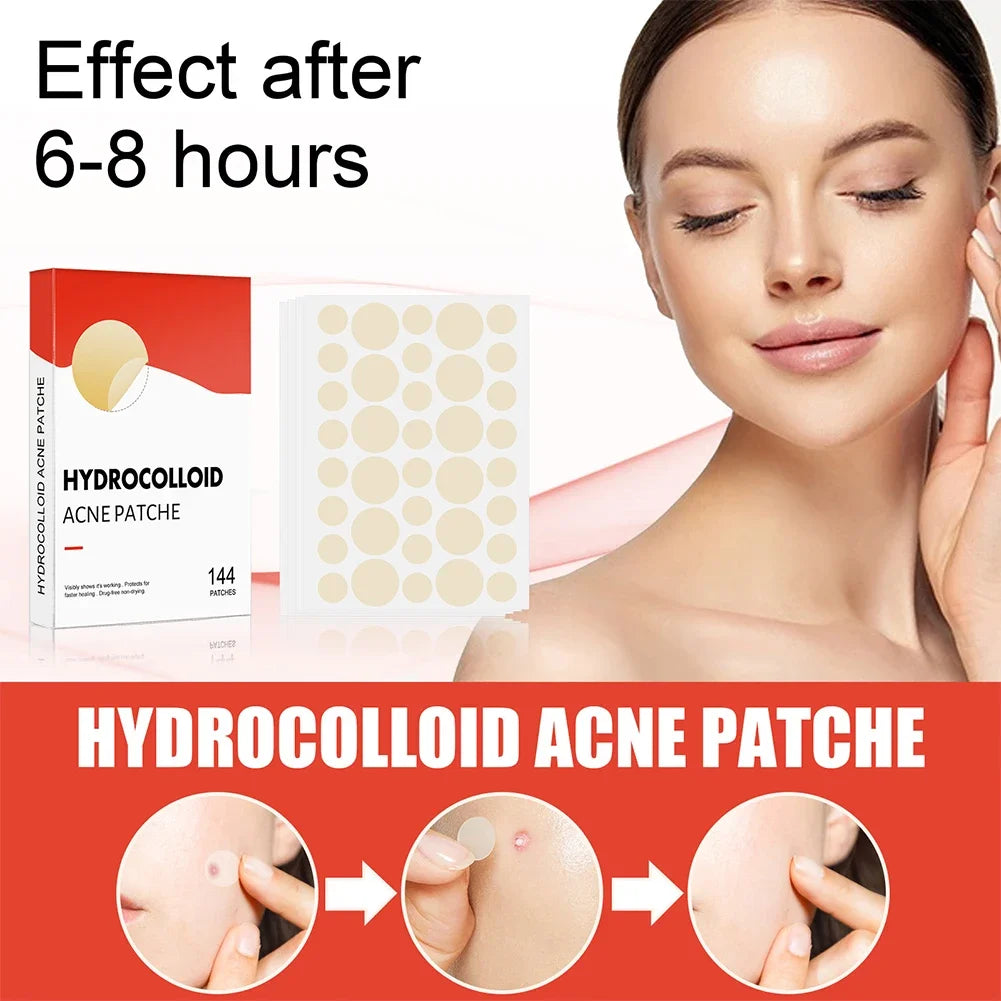 144pcs Invisible Professional Healing Pimple Patches 2 Sizes - Hart4Savings Hart4Savings 144pcs Hart 4 Savings