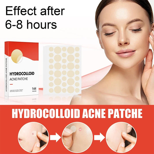 144pcs Invisible Professional Healing Pimple Patches 2 Sizes - Hart4Savings Hart4Savings 144pcs Hart 4 Savings